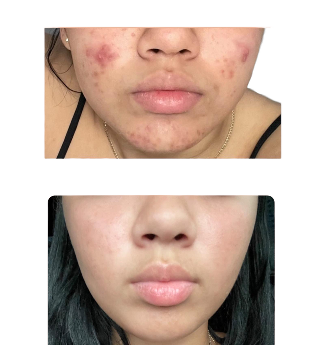 Sugar Cleanser
