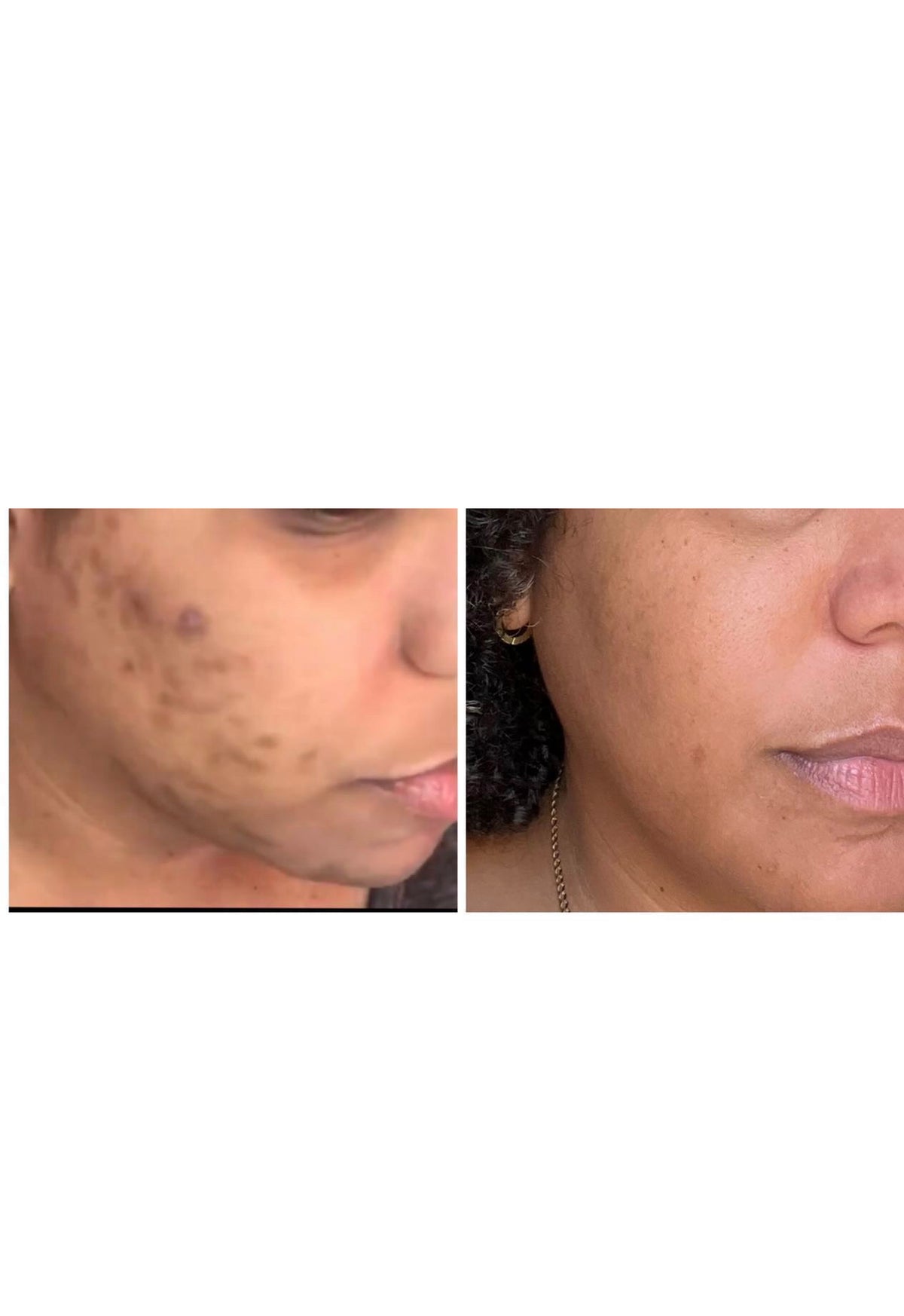 Sugar Cleanser